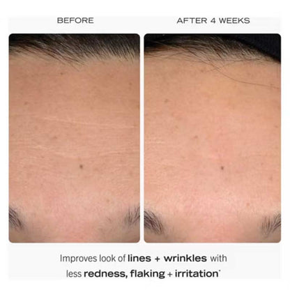 First Aid Beauty 0.3% Retinol Complex Serum with Peptides