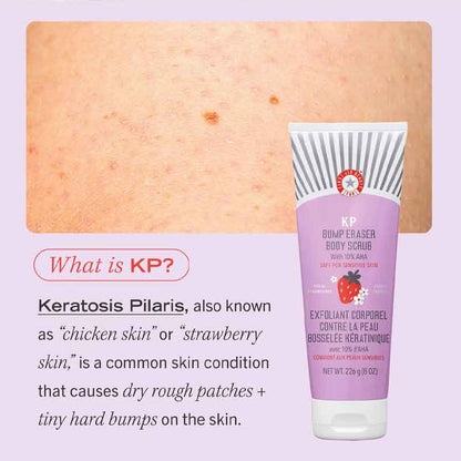 First Aid Beauty KP Bump Eraser Body Scrub Fresh Strawberry