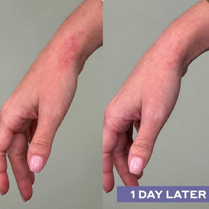 Mario Badescu Repairing Facial Spray With Hypochlorous Acid