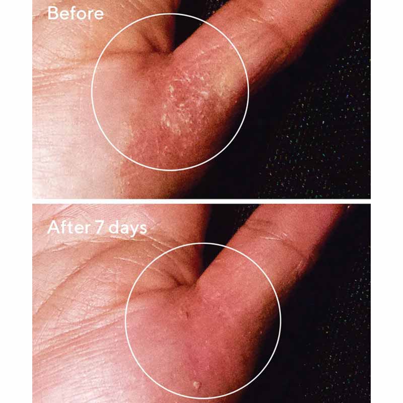 Murad Exasoothe Quick Relief Moisture Treatment