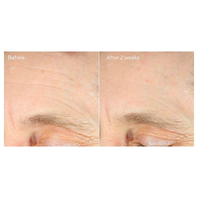Murad Intense Recovery Cream