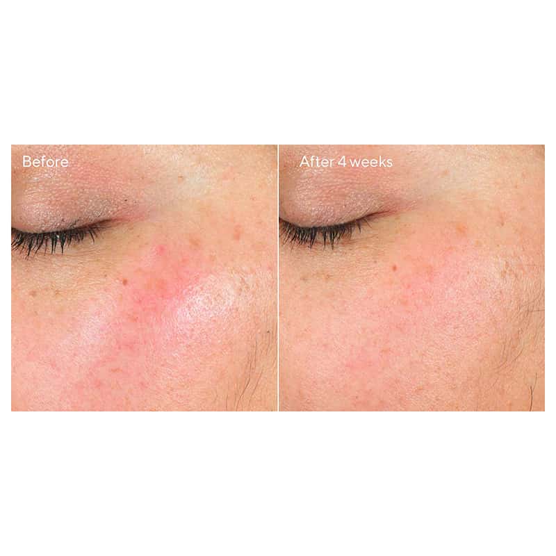 Murad Intense Recovery Cream